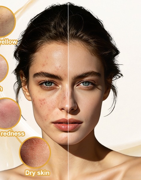 Model showing skin appearance comparison